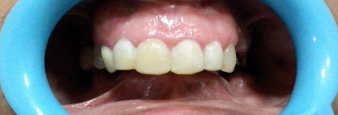 Dr. Sharmila Shinde’s Smile Dental Care