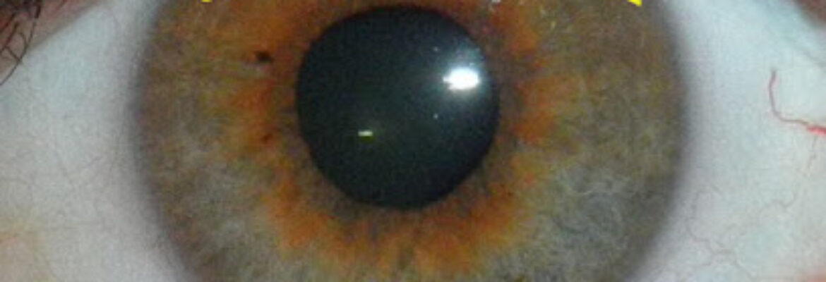 Gokhale Eye Hospital